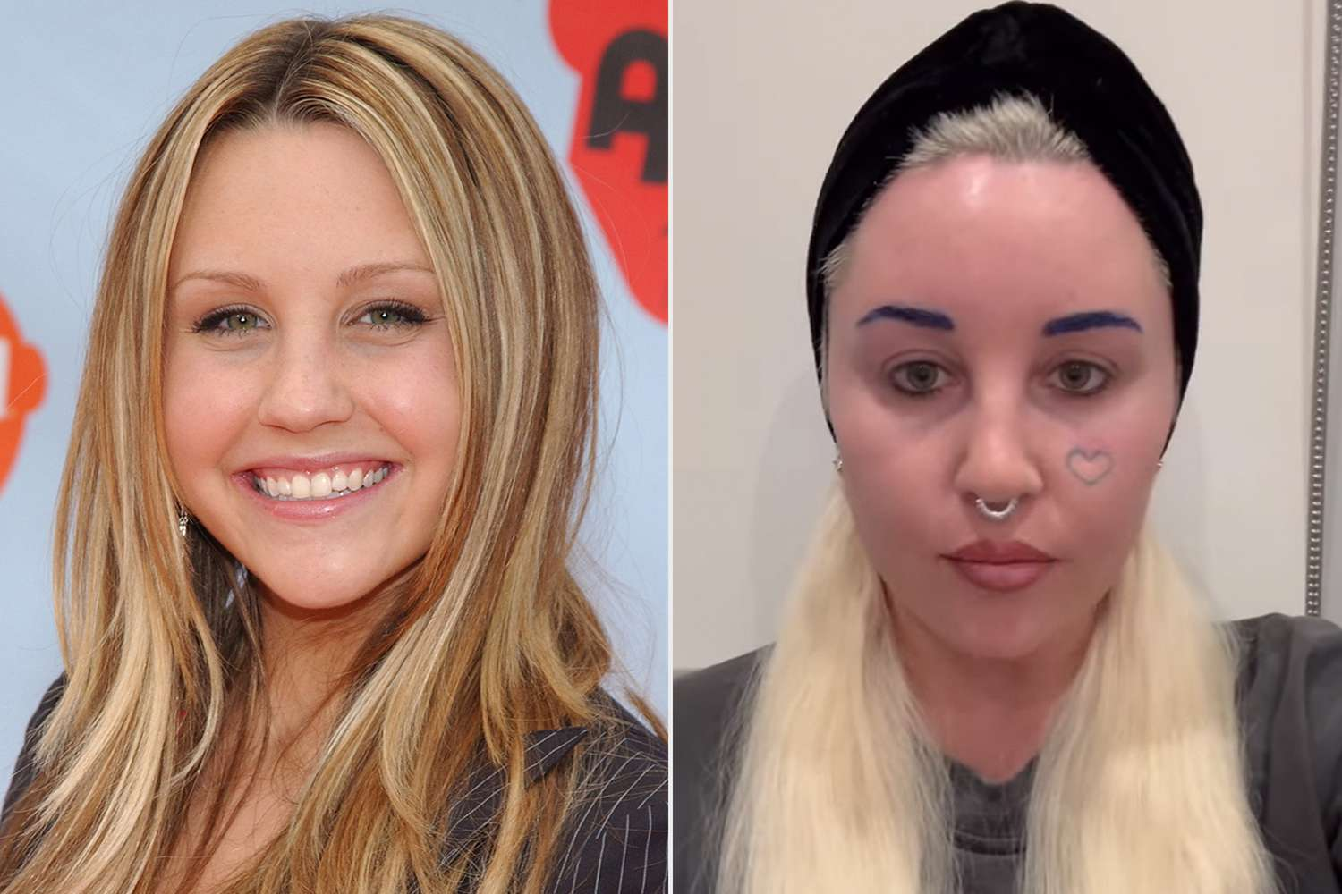 what happened to amanda bynes